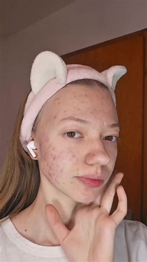 Tetyana 🌸 on Instagram: "*Werbung * Diese Maske ist ein echter Frische-Booster für die Haut ✨ L’Oréal Paris Revitalift Filler Glass Skin Hydrogel Maske spendet intensiv Feuchtigkeit und lässt die Haut sofort glatter, praller und strahlender aussehen. Die Maske fühlt sich angenehm kühlend an, sitzt perfekt auf dem Gesicht und verrutscht nicht. Nach der Anwendung ist die Haut nicht klebrig, sondern fühlt sich gepflegt und erfrischt an – der Glass-Skin-Effekt ist wirklich sichtbar. Werde ich defin