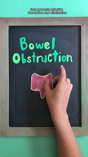 BOWEL OBSTRUCTION Review for Nursing Students A bowel obstruction is a blockage in the bowel that prevents effective absorption and elimination. It can be: ➡️ Partial – Narrowed GI tract where some contents still pass ➡️ Complete – Full blockage, nothing can pass (medical emergency) 🚨 Complete Blockage: → Leads to decreased blood flow to the bowel → Can cause tissue death and perforation Small Bowel Obstruction (SBO) Symptoms: → Colicky abdominal pain → Nausea & vomiting → Fluid and electrolyte