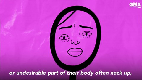 Body dysmorphia vs. Body dysmorphic disorder