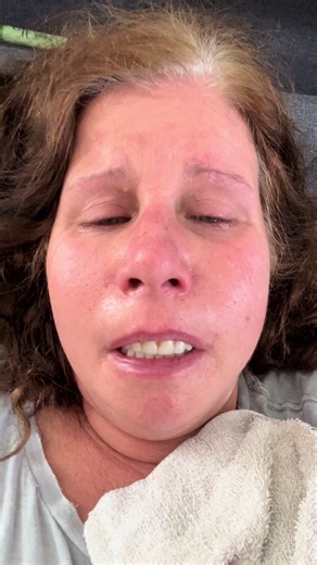 My Denture Journey: Day 1 After 26 Tooth Extractions