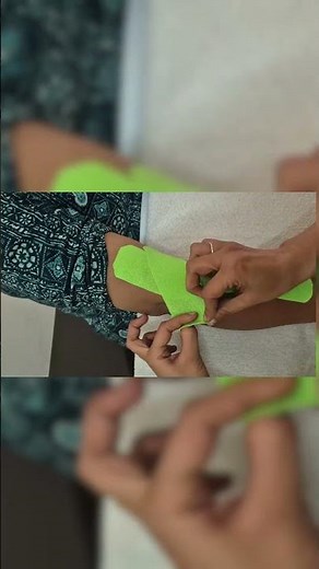 taping for elbow pain #tapping #physiotherapy #tenniselbowtreatment