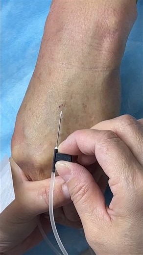 How to Give IV Inyección, Intravenous IV & IM Inyección | Step-by-step Intravenous IV technique :p17