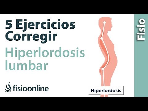 5 ejercicios para corregir la Híperlordosis lumbar o exceso de curvatura de espalda
