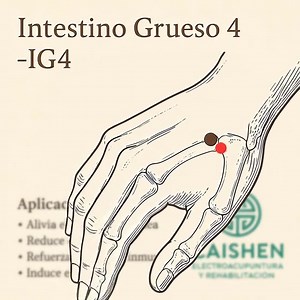 ACUPRESION IG 4 Hegu Neuralgia del trigémino y neuralgias faciales atípicas., parálisis facial periférica, vértigo, hipotonía muscular o espasticidad del miembro superior, hemiplejía y secuelas neurológicas de traumatismos craneales. rinitis, sinusitis, sordera, amigdalitis, faringitis, parotiditis, convulsiones infantiles, blefaritis, dacriocistitis, glaucoma, gripe, acné, forúnculos, urticaria, ptosis gástrica, estreñimiento y disentería, dolor de las muelas. Por último es indicado para el tra