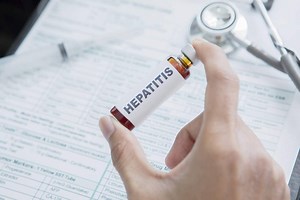 Aumento de casos: Los síntomas y consecuencias de la Hepatitis B