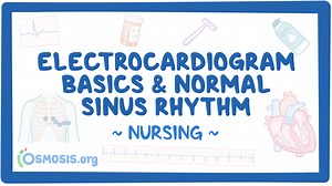 Electrocardiogram (ECG) - Normal sinus rhythm (NSR): Nursing: Video & Causes | Osmosis