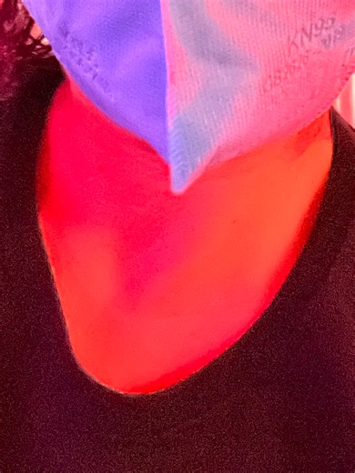 1 year ago I started my Zouk journey. It's been challenging, but also amazingly rewarding!! I've been able to participate in the miracle of movement, which I thought I'd never do again after cancer. When I pile on the daily issues from MS, including neuropathy, cognitive decline, & fatigue: I'm SO proud of my progress. I put the time in. I attended weekly classes. I practiced A LOT. I reviewed videos and then practiced more. I attended weekly practica after class. I attended at least 1 social pe