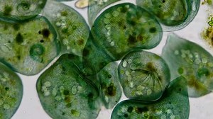 Replicating a 100-year-old experiment, HMS scientists re-discover the complex decision-making capabilities of a single-cell organism. Stentor footage courtesy of James Weiss (Jam's Germs) and Bill Porter. | Harvard Medical School