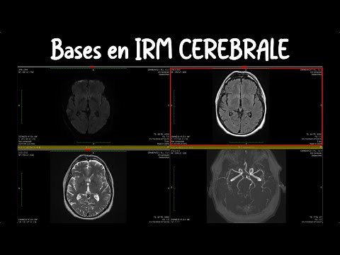 Essential elements of brain MRI for neurological examination (principles of interpretation for al...
