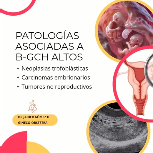🌿Beta-human chorionic gonadotropin (β-hCG) is a glycoprotein hormone with a heterodimeric structure, possessing two alpha chains and two beta chains, the latter being what defines its biological specificity. The alpha chains (92 amino acids) are identical to those of pituitary gonadotropins and thyroid-stimulating hormone, which explains the syndromic pathophysiology of some cancers that produce this hormone. ☘️β-hCG is primarily produced by trophoblastic cells (syncytiotrophoblast), which stim