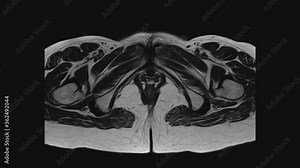 MRI of the female pelvic organs, abdominal cavity, gastrointestinal tract and bladder