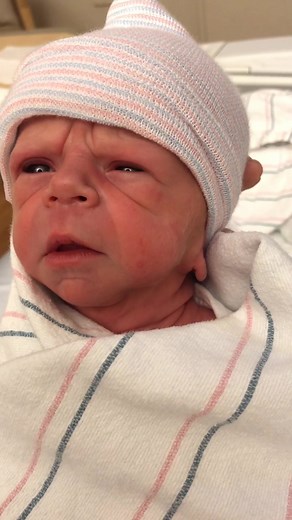 Understanding Williams Syndrome in Newborns