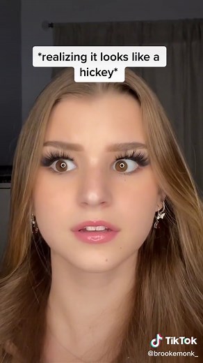 Neck Hickey Marks: Causes and Remedies