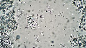 Microscopic milk bacilli float in the leaven in the microscope. Theme of foods background is under 1000x magnification. Milk product such as kefir or yogurt. Microcosmic background.