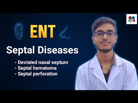 Deviated nasal septum | Septal hematoma and abscess | Diseases of nasal septum | ENT bangla lecture