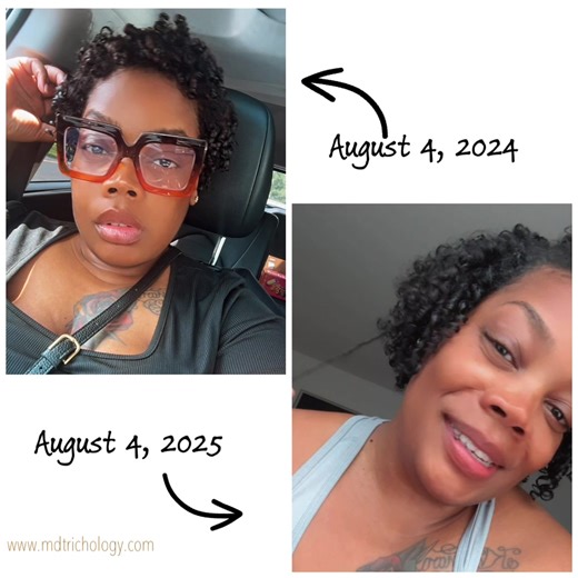 Transform Your Hair in 12 Months with Grow & Restore