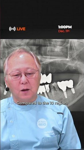 Dr. Park's Live Surgery 75th Preview