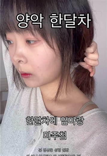 부정교합과 양악 수술 브이로그