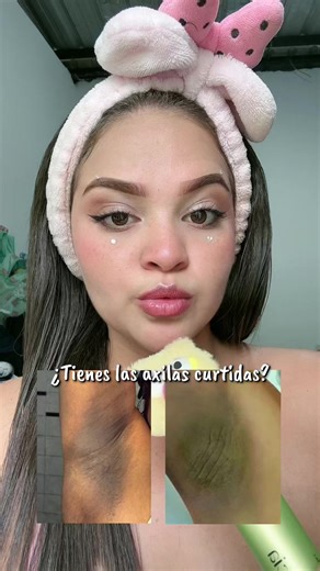 Cómo aclarar axilas oscuras con vitamina C — Tips rápidos