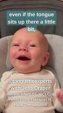 OT and Tongue Ties #shorts