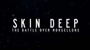 Skin Deep: The Battle Over Morgellons (Documentary)