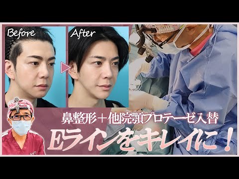 【整形】鼻と顎を整えてＥラインをつくる｜ヴェリテクリニック