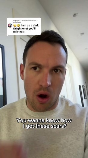 Why so serious? Exploring the Dark Knight's Arch-nemesis