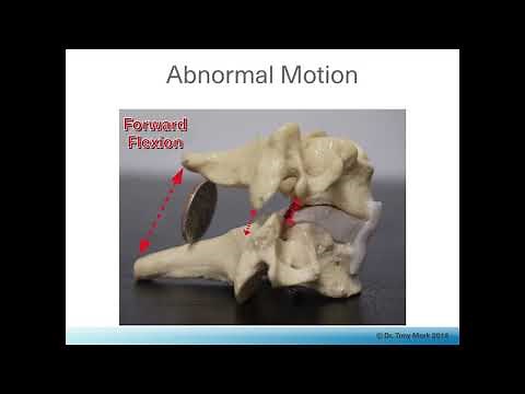 Cervical Facet Syndrome Treated with the Laser - Part 1