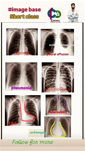 #educational #hospital #shortvideo #class