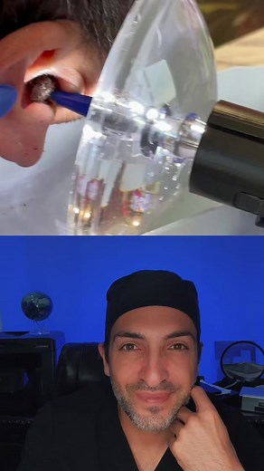 Effective Ear Wax Removal Techniques Explained