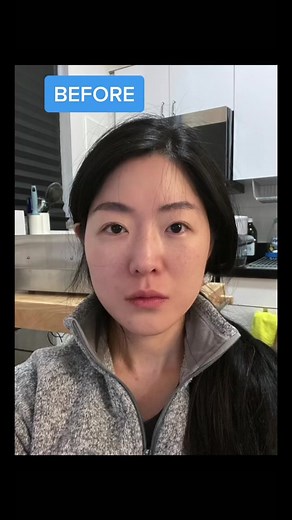 Short on time? Do this one move. These were my results after only 1 month😳 (fyi I did the full routine) also used @dior Capture Totale serum. The before photo was literally taken a couple months before I started doing the face massages, crazy! The full facial massage tutorial is in the video here: @gracemchoi #skincare #lymphaticdrainage #guasha #facial #facialmassage #antiaging #skin #cheekbones #jawline
