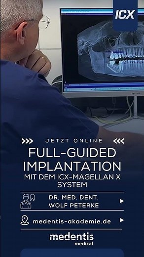 Full Guided Implantology mit ICX-Magellan | Dr. Peterke