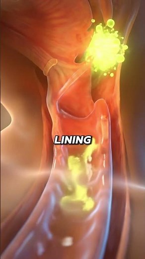 Wedge Pillow Ends Acid Reflux Overnight! 🔥 Inside Your Chest & Throat Changes