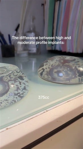375cc Implants: Moderate vs High Profile (What’s the Difference?)