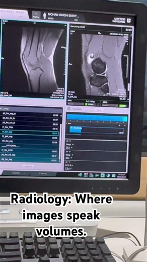 MRI knee #radiology #mri #medicalstudent #viralvideo #paramedical
