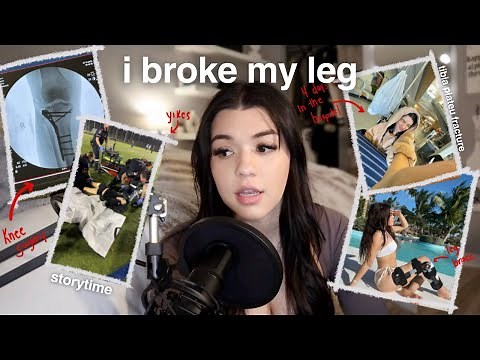 I BROKE MY LEG & this is what happened...