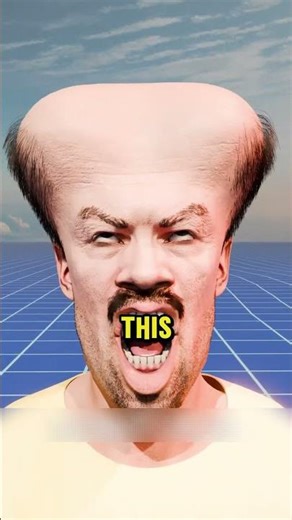 How Can Someone Be Born With Two Heads!