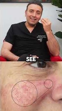 Skin Lift vs SMAS Facelift… What’s the Difference? 🤔