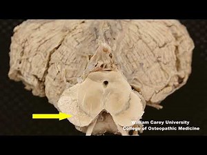 Basal ganglia-related areas in midbrain#neuroanatomy#substantia nigra #neuroscience#brain#midbrain