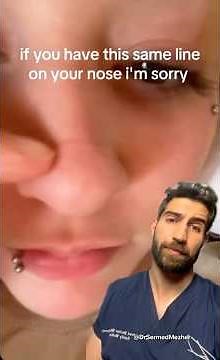POV: You Have This Line on Your Nose