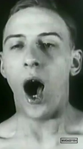 Understanding Shell Shock in World War 1