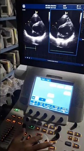 GE Vivid E9 Ultrasound Review & Cardiac Imaging Guide | Complete Tutorial