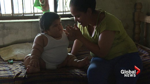 Mexican baby weighs 62 pounds at 10-months-old