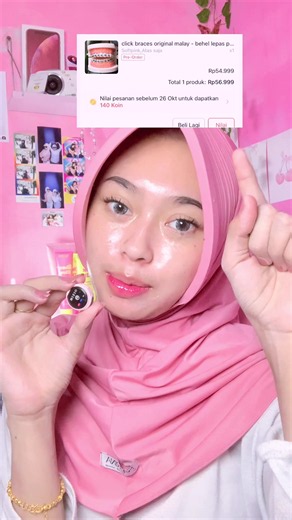 Review Behel Fashion 60.000: Pasang, Nyeri, dan Hasil Setelah Sebulan