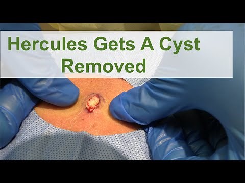 Hercules Gets A Cyst Removed | Dr. Derm