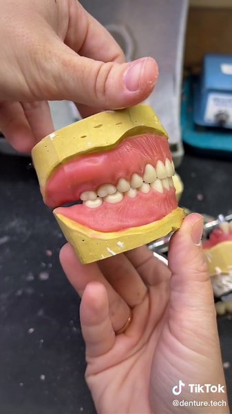 Smile Makeover Techniques Demonstrated on Dental Model