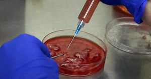 New approach in fighting brain cancer may help lengthen patients' lives