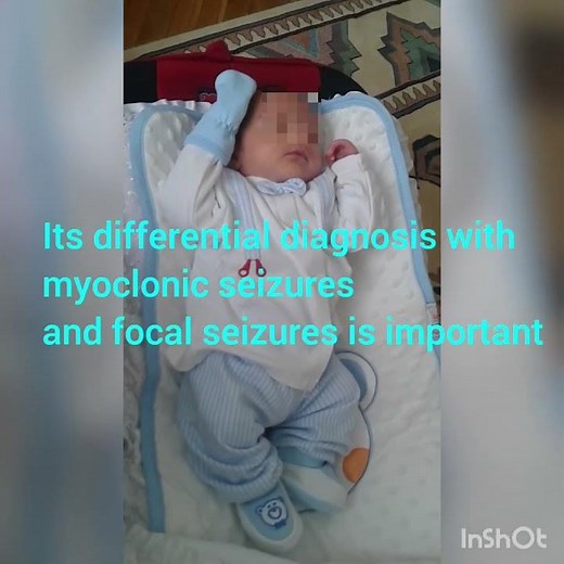 Benign Sleep Myoclonus