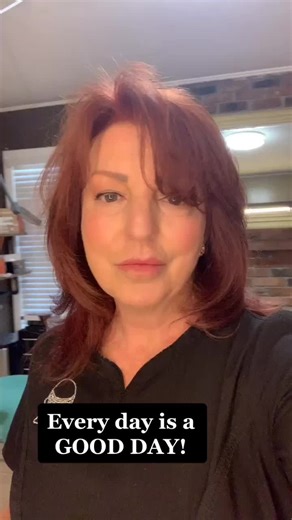 Get your hairline right! Fresh to Death in 14 days!! #ct #nyc #nj #smp #scalpmicropigmentation #hairtattoo #hairline #balding #redhairdontcare