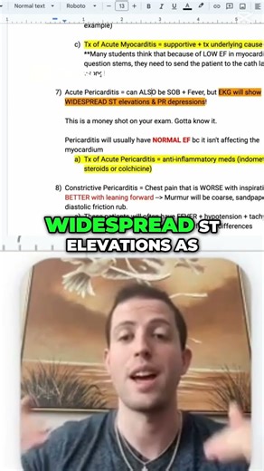 Pericarditis EKG Clues Every Student Should Know #usmle #step2